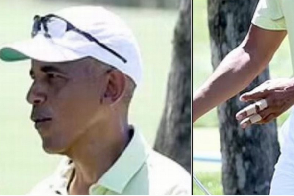 STUNNING: Barack Obama Emerges With Black Eye, Bandaged Hand After Death of Personal Chef